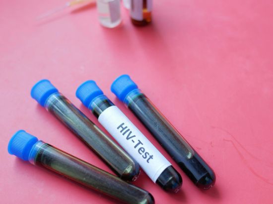 hiv